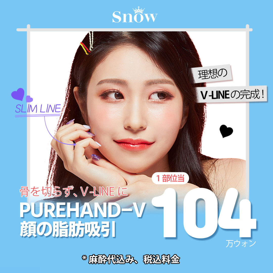 Hút mỡ mặt tạo V-line | Điều trị mặt nhỏ không cần gọt xương | Phòng khám Snow Gangnam