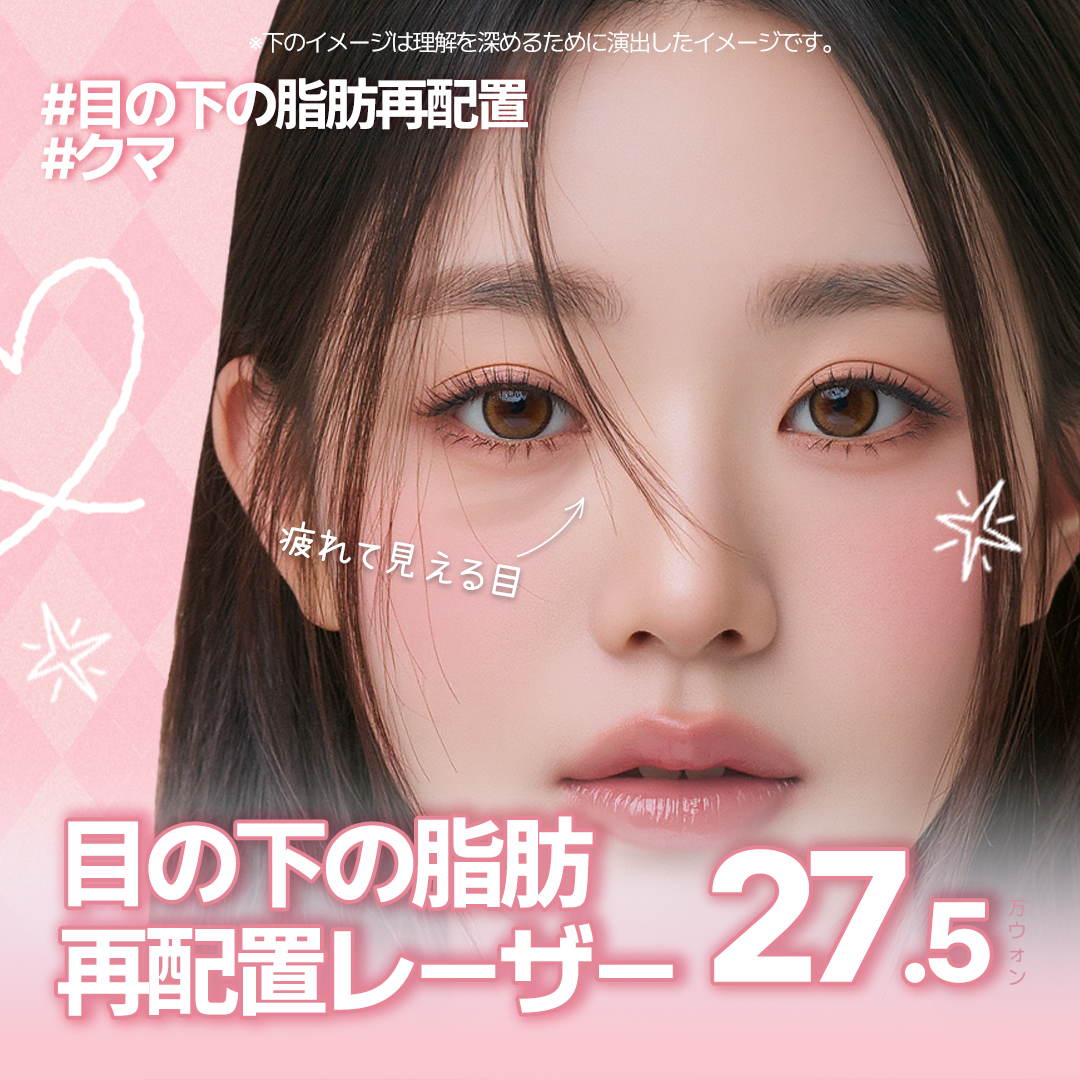 Cải thiện quầng thâm・mỡ dưới mắt Laser sóng cao tần + Filler Collagen hướng tới vùng mắt trẻ trung | Gangnam Jfeel Clinic