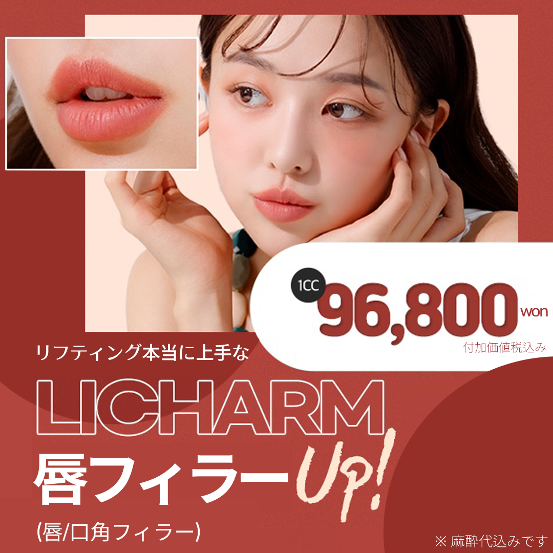 Filler Hyaluronic Acid môi và khóe miệng cũng có thể mong đợi hiệu quả rút ngắn nhân trung | Điều trị bởi bác sĩ chuyên khoa tạo hình | Phòng khám Phẫu thuật Thẩm mỹ Licham