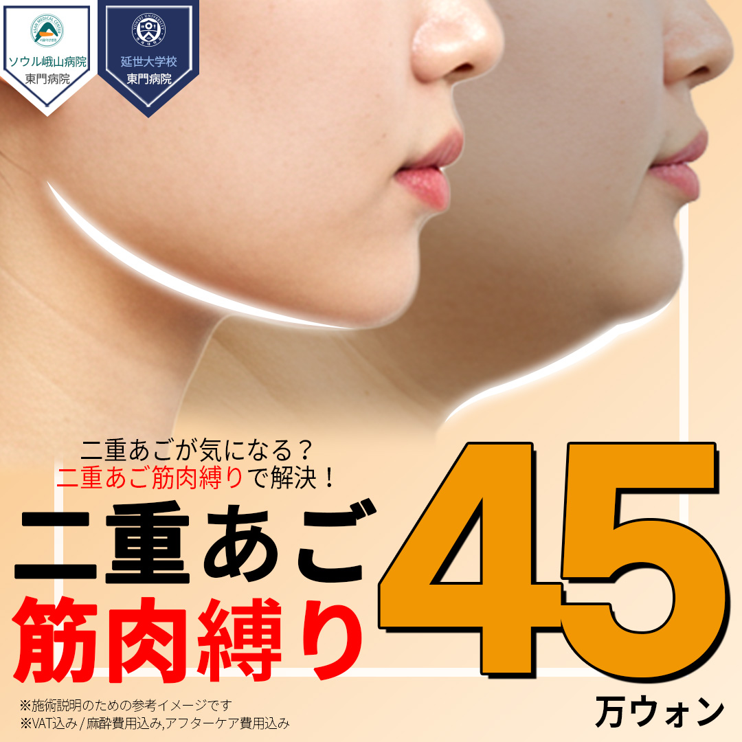 Điều trị buộc cơ nọng cằm | Hơn 30 năm thành tích tạo mặt V-line | Jerim Apgujeong