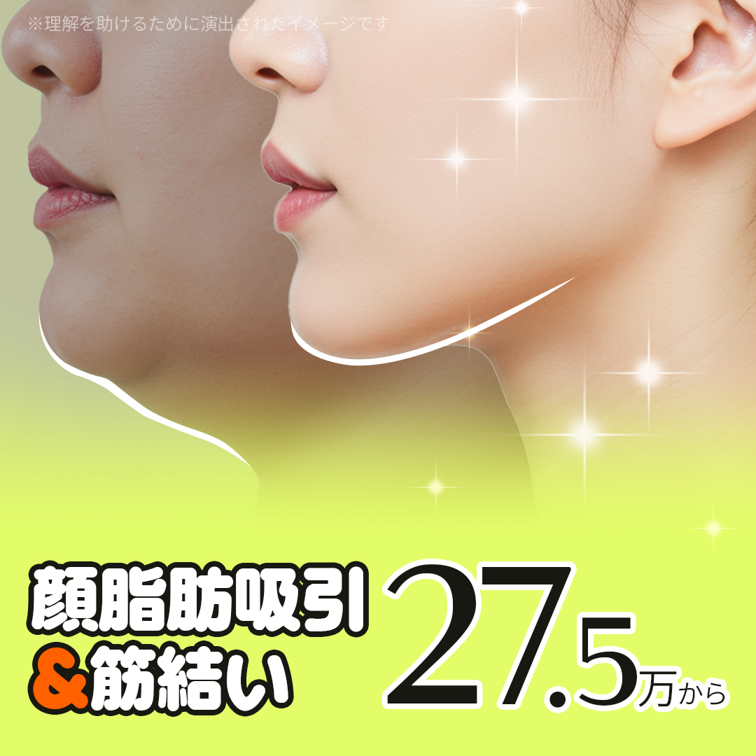 Hút mỡ mặt và buộc cơ | Cải thiện đường viền khuôn mặt | Clara Gangnam