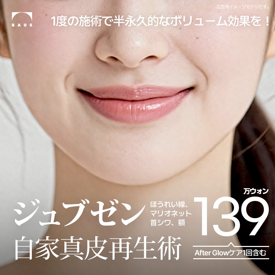 Hiệu quả bán vĩnh viễn - Phẫu thuật tái tạo chân bì tự thân Jubzen_Hiệu quả căng, tăng volume, tạo collagen_Làn da trẻ trung khỏe mạnh bằng mô của chính mình_Áp dụng cho nếp nhăn rãnh mũi miệng, trán, cổ