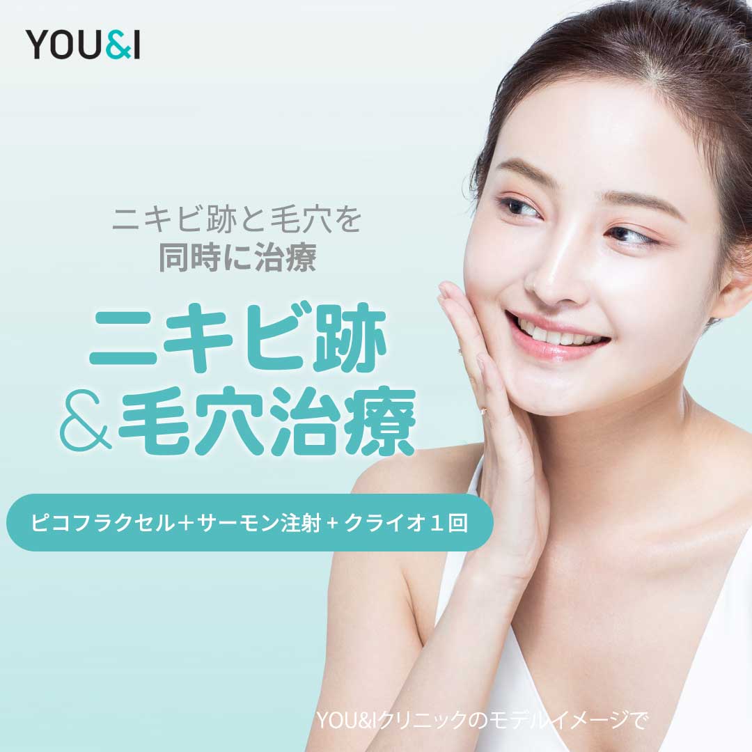 【Pico Fractional + Tiêm cá hồi + Cryo】Liệu pháp kết hợp chăm sóc đồng thời sẹo mụn và lỗ chân lông để có làn da đẹp