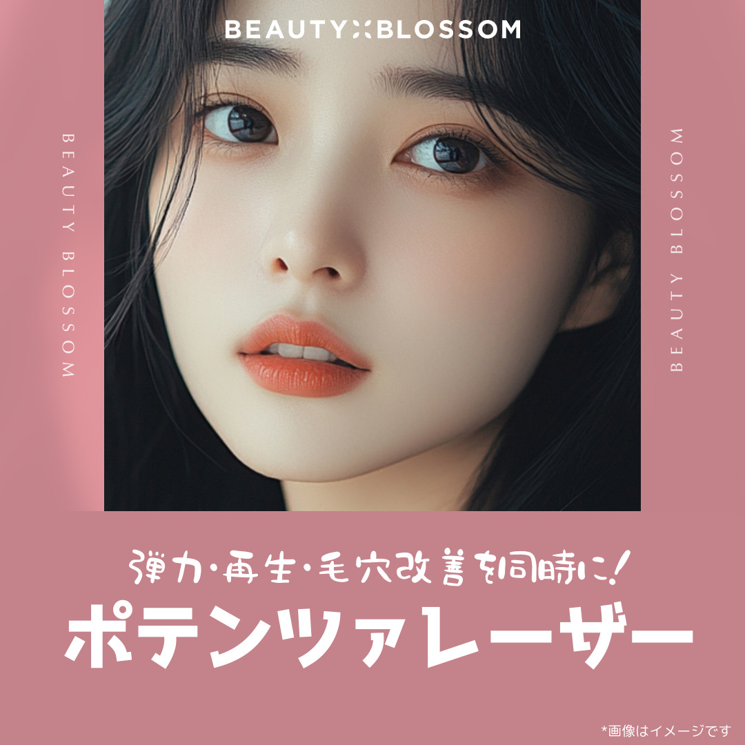 Chăm sóc lỗ chân lông・đàn hồi・tái tạo da với Potenza Laser | Phòng khám Beauty Blossom Hongdae【26.199 yên】