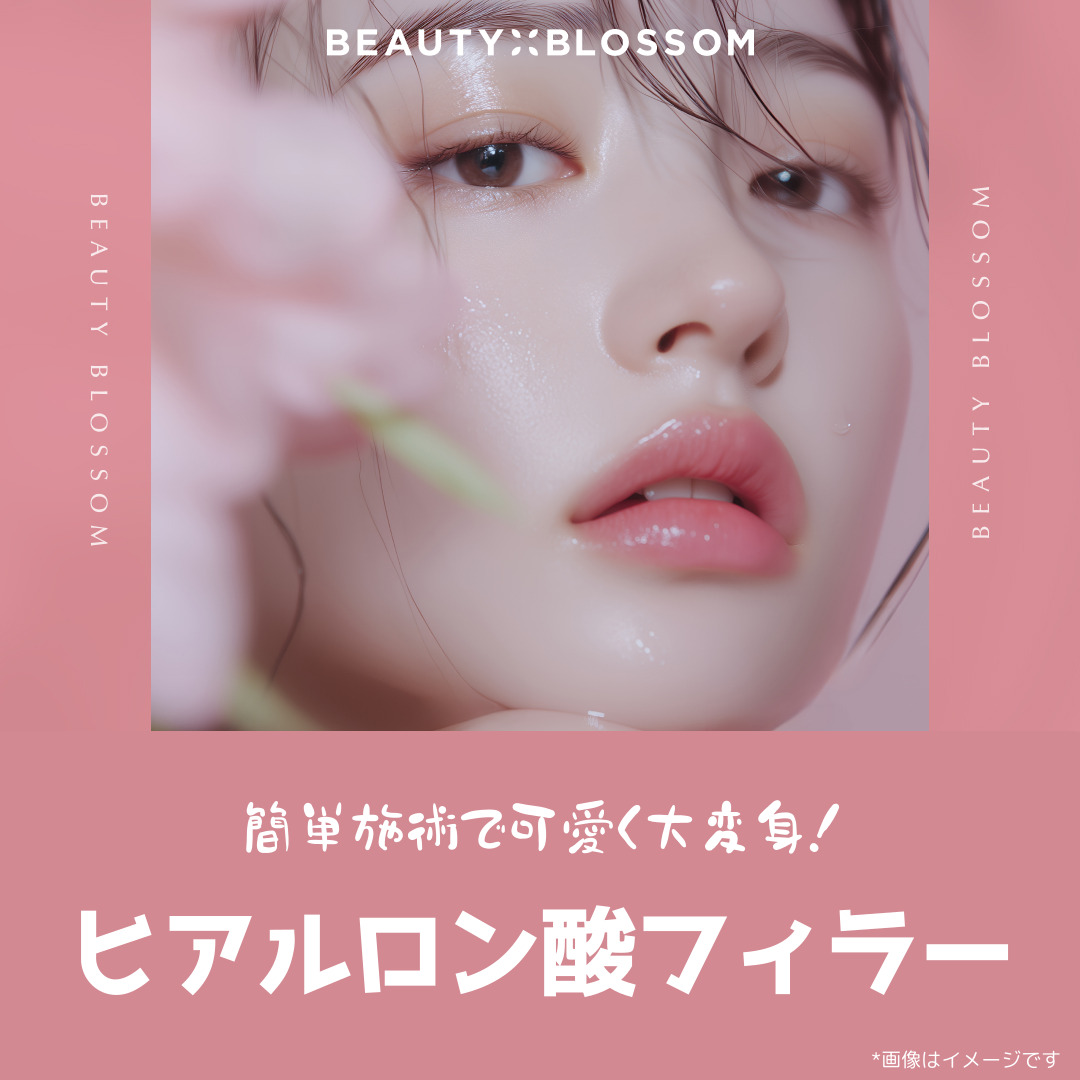 Liệu trình Hyaluronic Acid Filler | Tăng volume trán, mũi, rãnh mũi-má, cằm | Phòng khám Beauty Blossom Seoul Hongdae