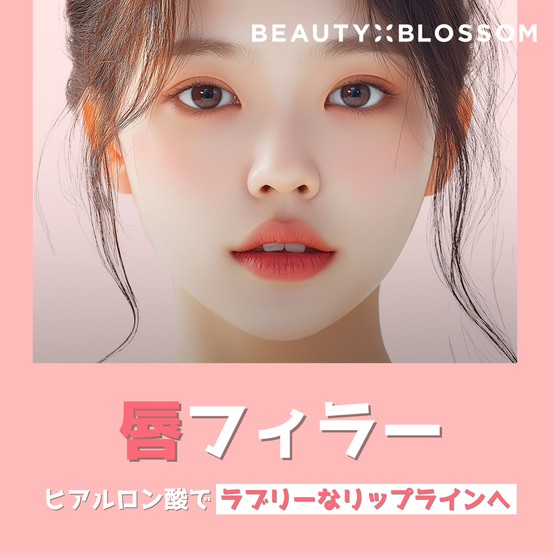 Filler môi (tiêm Hyaluronic Acid) hướng đến môi căng mọng｜Phòng khám Beauty Blossom Hongdae Seoul