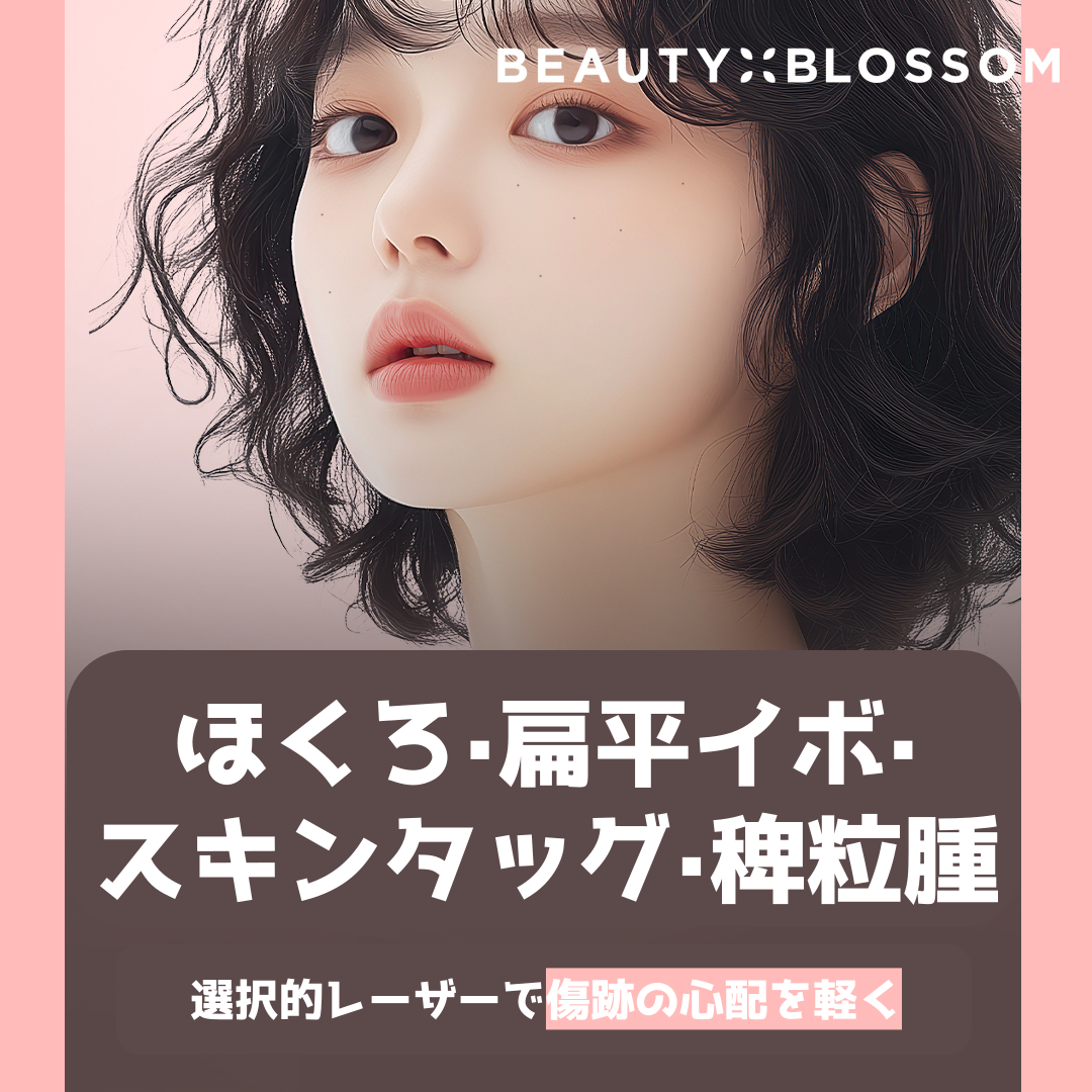 Loại bỏ nốt ruồi, mụn cóc phẳng, mụn thịt, mụn kê bằng laser | Phương pháp điều trị chú ý đến gánh nặng cho da xung quanh