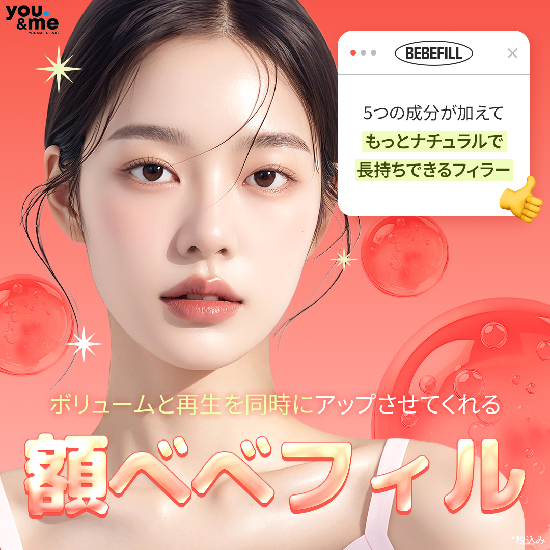 Bebe Fill trán｜Thủ thuật kỳ vọng tạo độ căng tự nhiên với 5 thành phần phối hợp｜Phòng khám Yuen Mi Gangnam Seoul