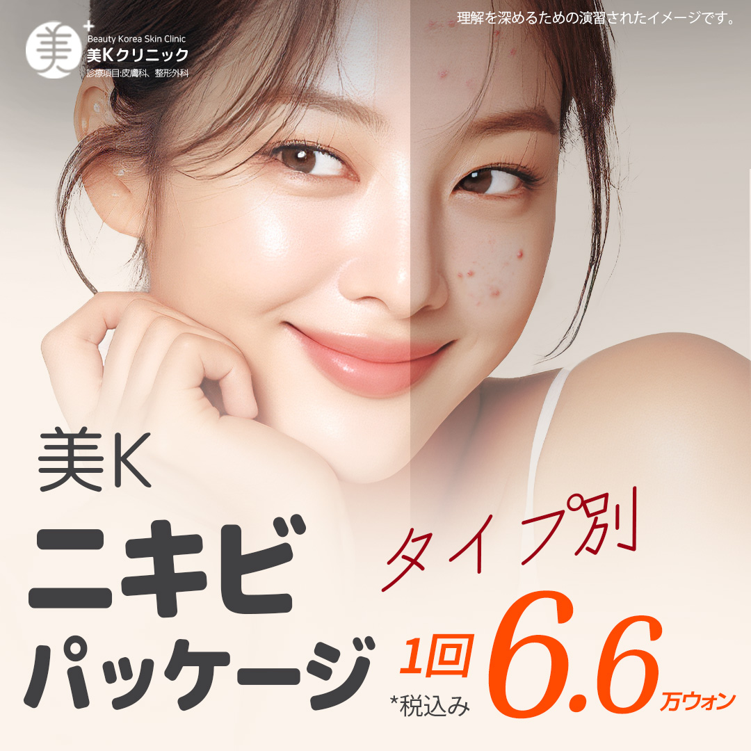 Gói chăm sóc mụn・lỗ chân lông | Aqua Peel × Laser Toning × Fraxel | Phòng khám Mikei ga Gangnam Seoul