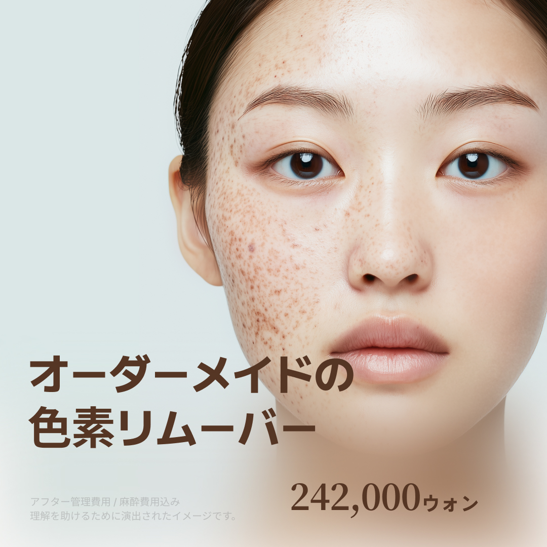 Chăm sóc nám, đốm nâu, sắc tố bằng chẩn đoán da 3D ga Sinnonhyeon Hàn Quốc | Laser sắc tố tùy chỉnh | Phòng khám Wooubit