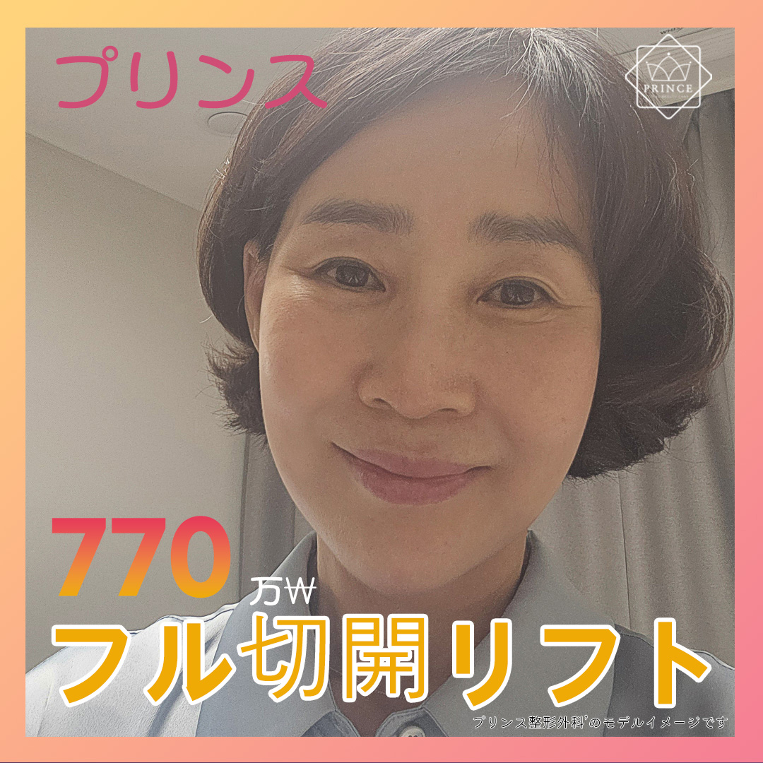 SMAS Full Căng Da Mặt Rạch｜Nâng 3 lớp từ lớp cơ cho hiệu quả kéo dài｜Phòng khám Thẩm mỹ Ngoại khoa Prince