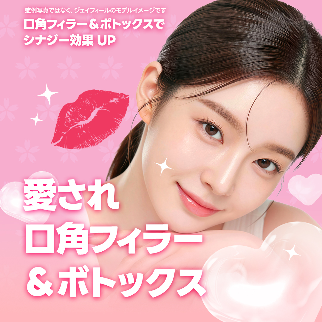 Filler khóe miệng & Botox hướng đến ấn tượng nụ cười tự nhiên｜Thủ thuật thiết kế chọn từ 3 loại｜Phòng khám Jfeel Hongdae