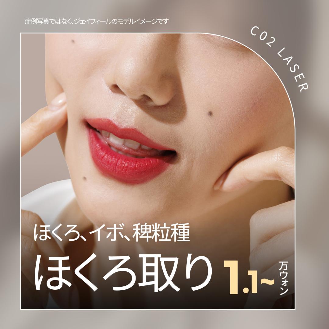Xóa nốt ruồi bằng CO2 Laser | Từ 1.191 yên Thực hiện giảm sẹo | Seoul Gangnam stn.・Phòng khám Jfeel Gangnam