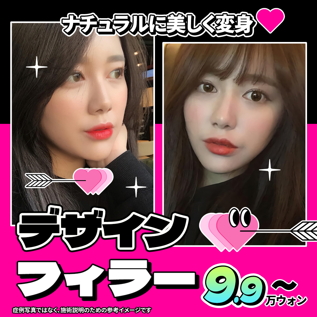 Filler hyaluronic acid Jfeel Phòng khám Gangnam Hàn Quốc | Liệu trình hướng đến độ lập thể tự nhiên cho môi, mũi, trán【Từ 10,718 yên】