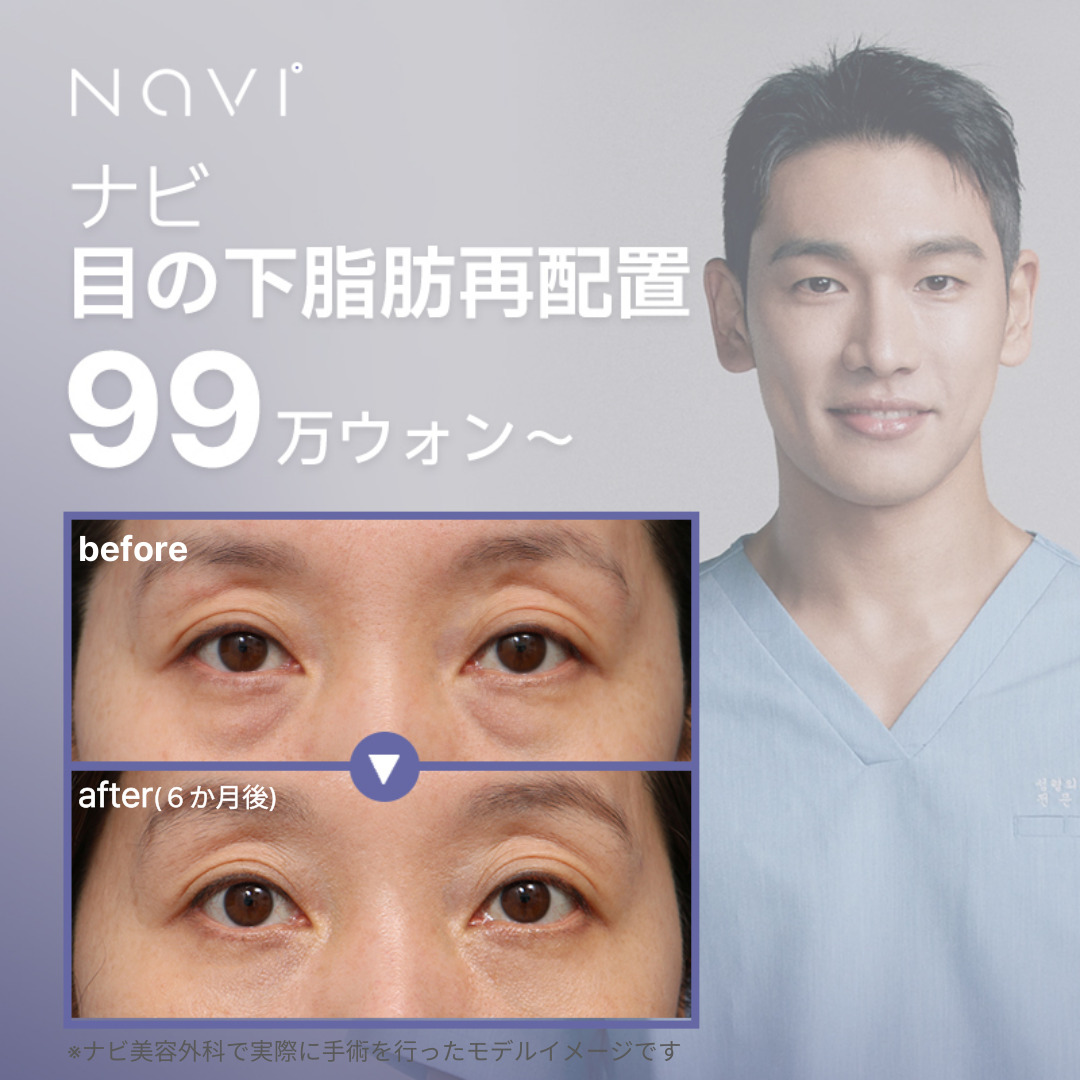 Tái phân bổ mỡ dưới mắt｜Bác sĩ chuyên khoa phẫu thuật tạo hình 25 năm kinh nghiệm đảm nhận｜Navi Plastic Surgery Seoul Gangnam