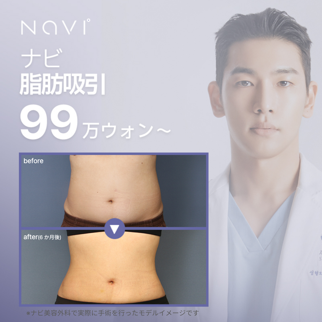 Hút mỡ của Navi Plastic Surgery｜Cách ga Nonhyeon Gangnam Seoul 1 phút đi bộ｜Thủ thuật hướng tới đường viền cơ thể cân đối
