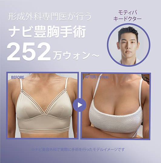 Phẫu thuật nâng ngực Motiva Hàn Quốc | Hệ thống 1 đối 1 an tâm với bác sĩ chuyên khoa tạo hình trực tiếp phẫu thuật | Nabi Plastic Surgery