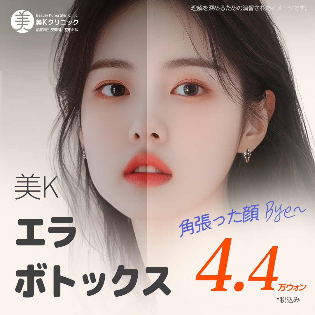 Botox hàm ga Gangnam Hàn Quốc 4.763 yên | Mi K Clinic nhằm tạo V-line tự nhiên