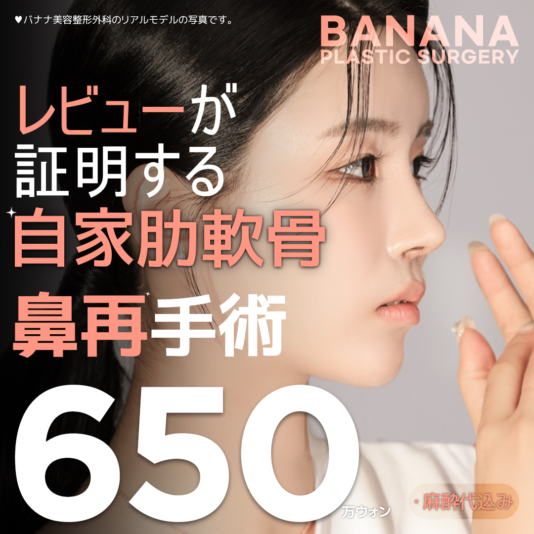 Hướng tới mũi lý tưởng với phẫu thuật lại mũi sụn sườn tự thân | Hỗ trợ xét nghiệm chính xác 3D-CT | Banana Phẫu thuật Tạo hình Thẩm mỹ