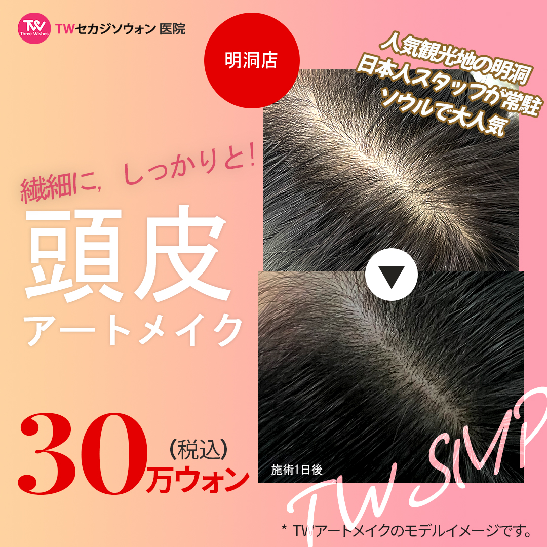 Phun xăm da đầu | Myeongdong Sekaji Sowon Clinic | Điều trị che phủ tóc thưa với nhân viên Nhật thường trực