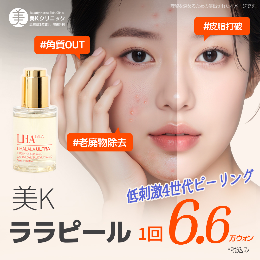 Lara Peel tại Phòng khám MiK Seoul ga Gangnam | Peel thế hệ 4 ít kích ứng để chăm sóc da đẹp