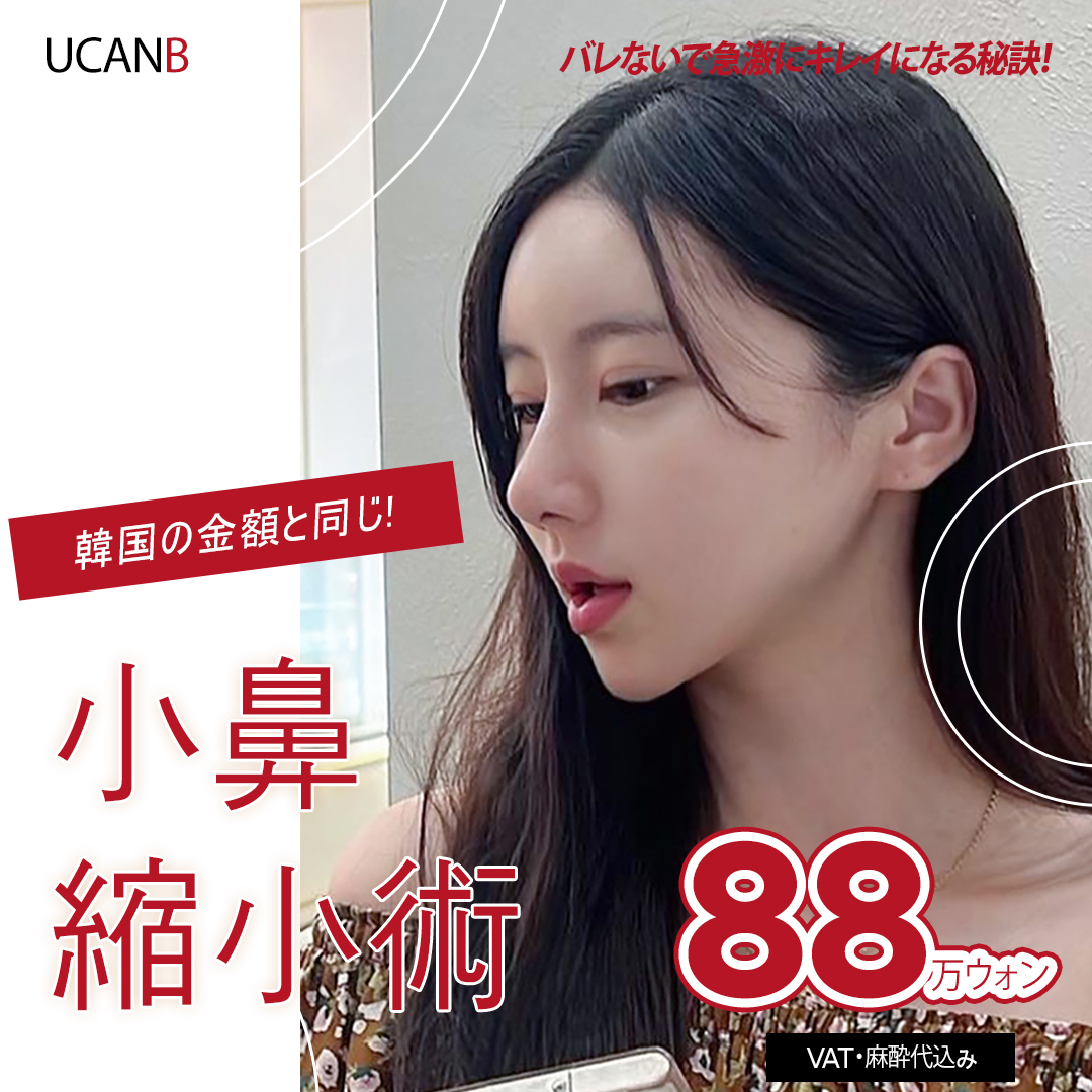 Thu nhỏ cánh mũi | Hướng tới độ bền bằng cố định màng xương | Thủ thuật khoảng 30 phút | U Can Be Phẫu thuật Thẩm mỹ | Hàn Quốc Gangnam