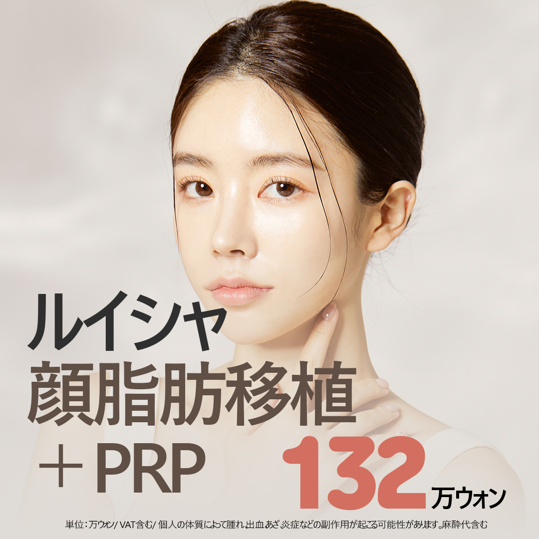 Ghép mỡ mặt + PRP｜Hướng tới volume tự nhiên bằng mỡ tự thân｜Luixa Clinic【Gangnam】