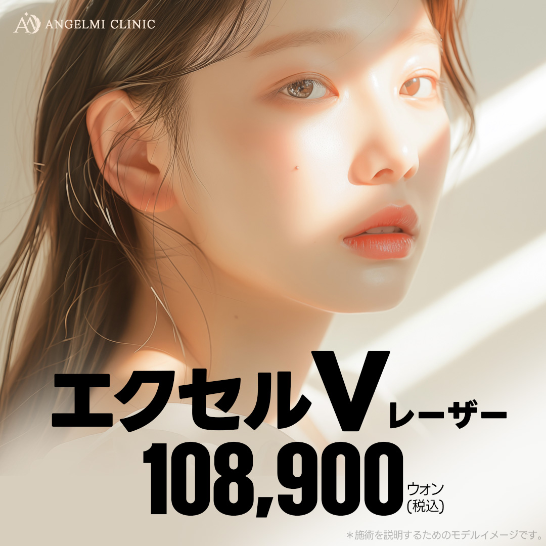 Hướng tới cải thiện da đỏ・tàn nhang với Laser Excel V | Điều trị làm đẹp da thiết kế giảm đau | Phòng khám Angelmi
