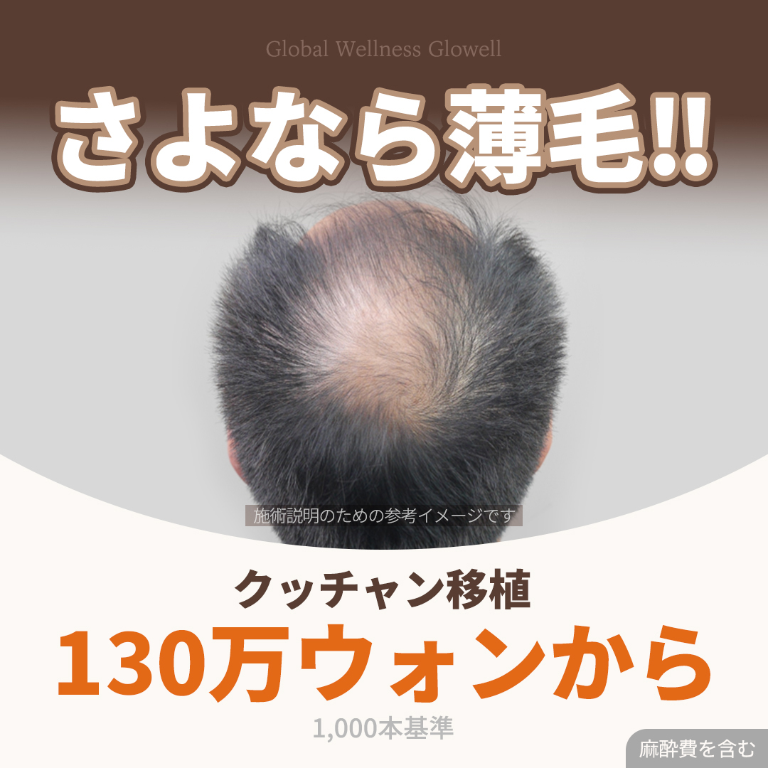 Cấy tóc tự thân Kkutchan Hàn Quốc | Hướng đến cải thiện tóc thưa với rạch + không rạch + xăm tóc y tế | Growwell Phòng khám Yeouido