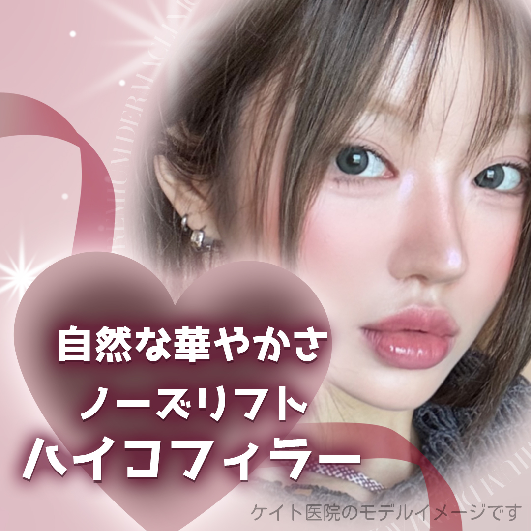 【Hàn Quốc Hongdae】Super Hiko Nose Lift | Nâng mũi tự nhiên bằng chỉ và filler | Phòng khám Kate