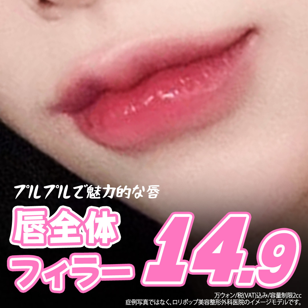 Filler môi để có đôi môi căng mọng volume | Thiết kế theo yêu cầu | Lollipop Plastic Surgery (Ga Sinsa, Seoul)