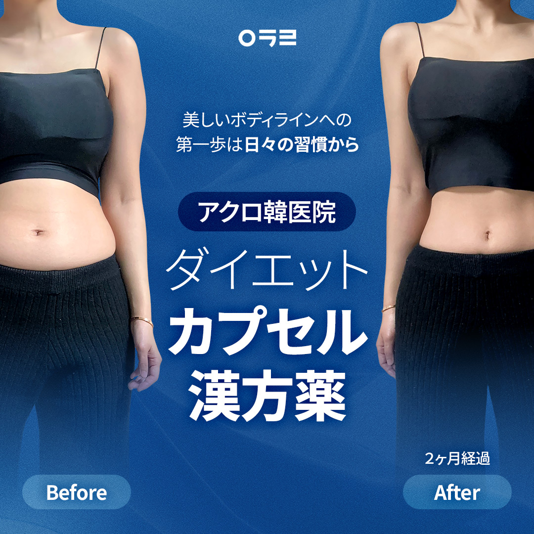 Thuốc đông y viên nang giảm cân tại Hàn Y viện Acro | Hỗ trợ giảm cân khỏe mạnh với đơn thuốc tùy chỉnh 1:1 | Seoul Sinnonhyeon