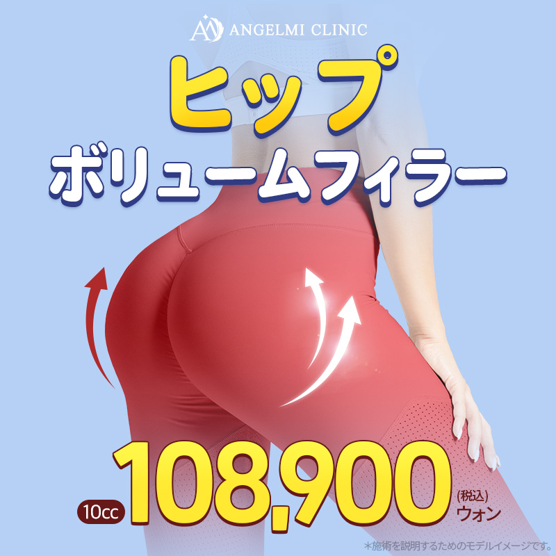 Filler tăng độ căng mông｜Tiêm Hyaluronic Acid không cần rạch hướng đến nâng mông｜Phòng khám Angel Mi Apgujeong