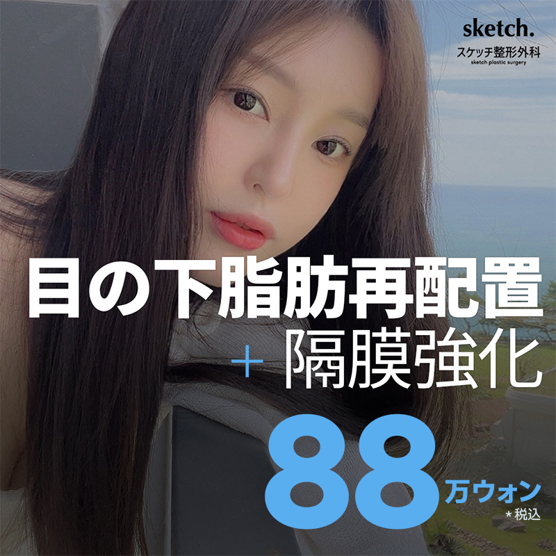 目の下脂肪再配置＋隔膜強化｜クマ・たるみ改善を目指す施術｜江南スケッチ美容外科