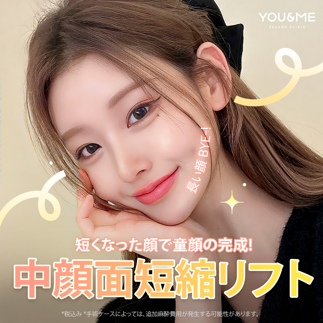 Lift thu ngắn phần giữa mặt | Chỉ nâng không rạch hướng đến ấn tượng tươi trẻ | Phòng khám Younmi Seoul Gangnam