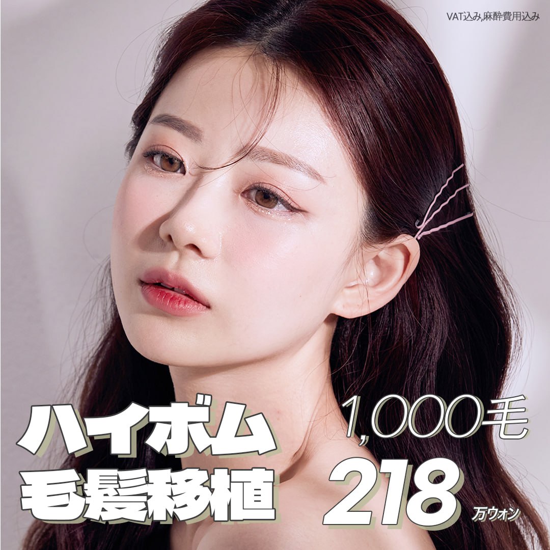 Cấy tóc Hàn Quốc 1000 nang | Giới hạn 1 người/ngày, điều trị tận tình bởi bác sĩ chuyên khoa | Hi-Beom Clinic Gangnam Seoul