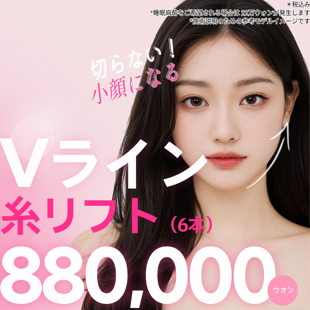 Chỉ nâng V-line 6 sợi tại Viện thẩm mỹ Honesty ga Sinsa Hàn Quốc｜Thủ thuật nâng cơ mặt nhỏ không dao
