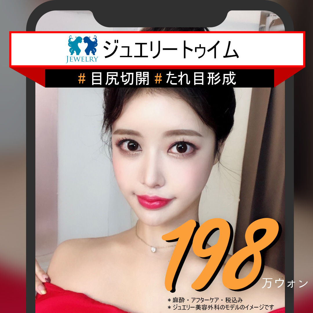 Hướng tới đôi mắt dịu dàng to với Jewelry Teuim (Cắt đuôi mắt + Tạo mắt cụp) | Seoul Sinsa stn.・Phòng khám Jewelry Thẩm mỹ