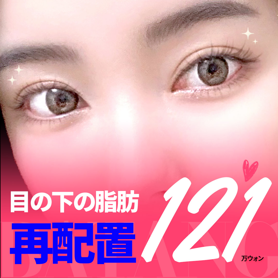 Tái phân bổ mỡ dưới mắt (Trị quầng thâm) hướng đến vùng mắt trẻ trung | Hỗ trợ phương pháp Hamra trong | Batan Thẩm mỹ Ngoại khoa