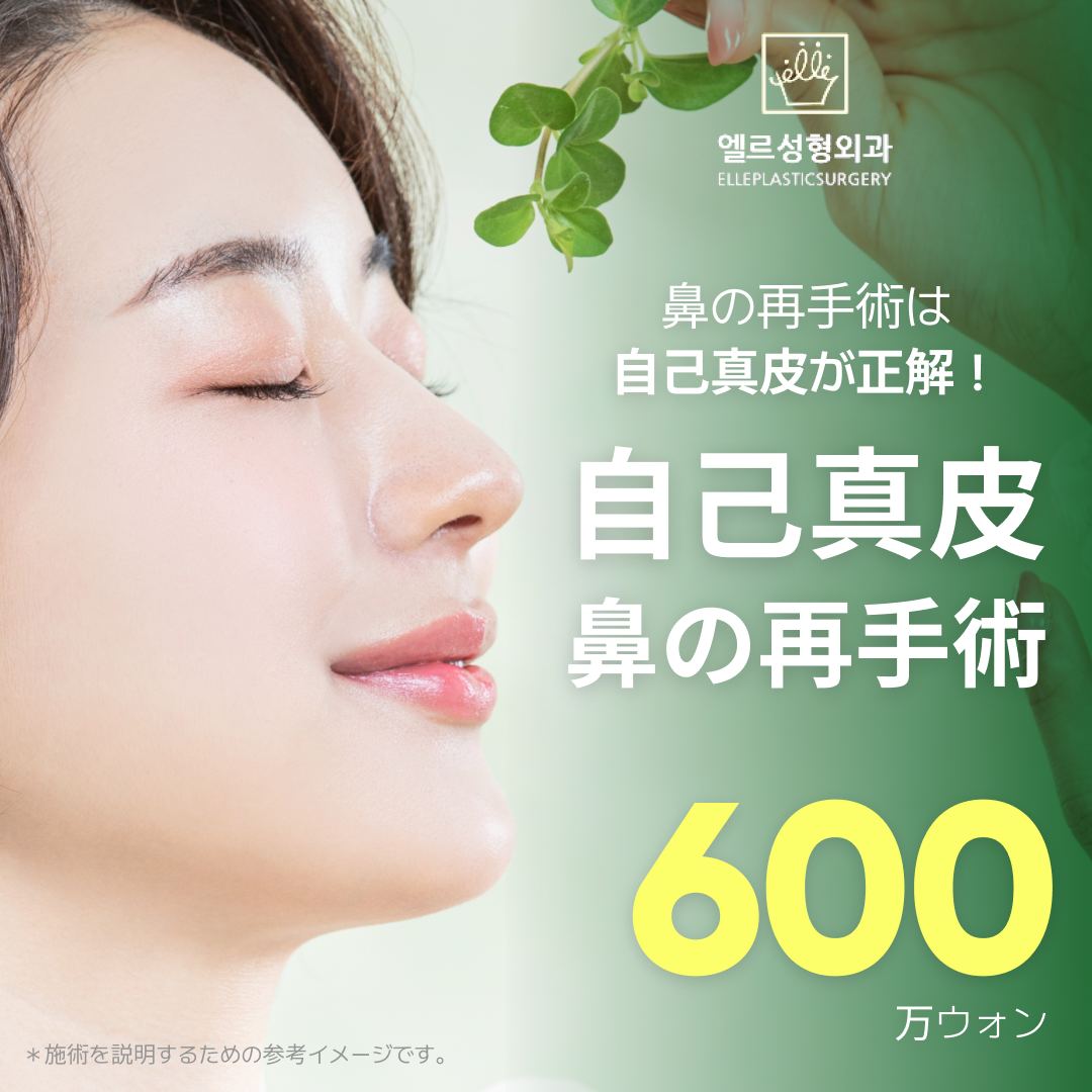 Phẫu thuật lại mũi da tự thân | Phẫu thuật chỉnh sửa an toàn sau loại bỏ túi độn | Bác sĩ đăng bài SCI tại viện | L Phẫu thuật Thẩm mỹ