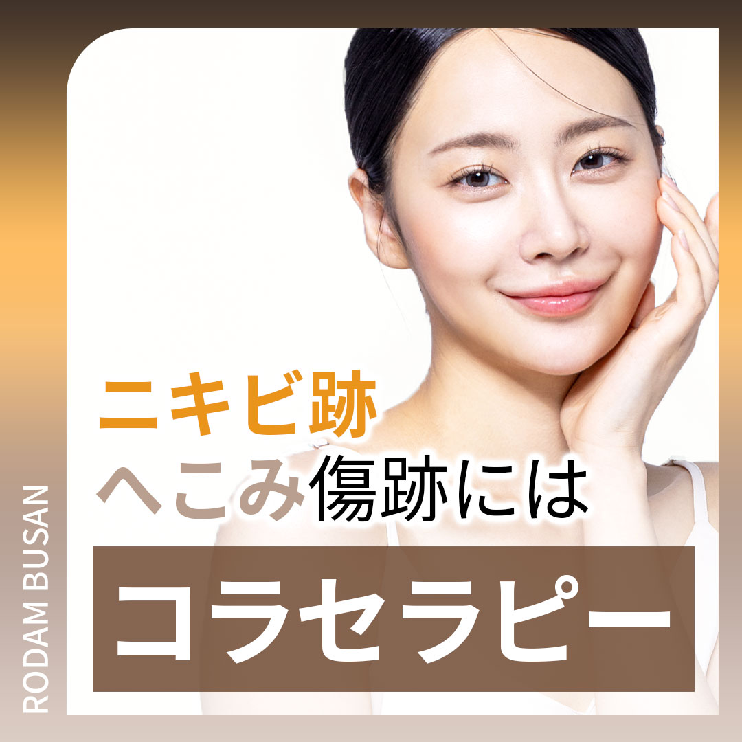 Điều trị sẹo mụn và sẹo rỗ Colatherapy lần đầu 5,413 yên | Liệu trình chuyên về sẹo được cấp bằng sáng chế | Rodam Hàn y viện Busan