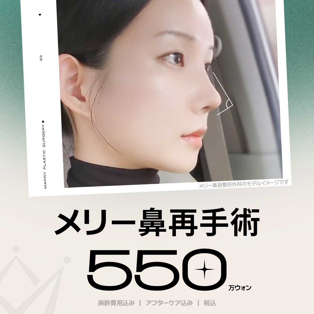 メリー鼻再手術｜3D-CT精密分析×1日1件限定の丁寧な修正手術｜狎鴎亭駅メリー美容整形外科