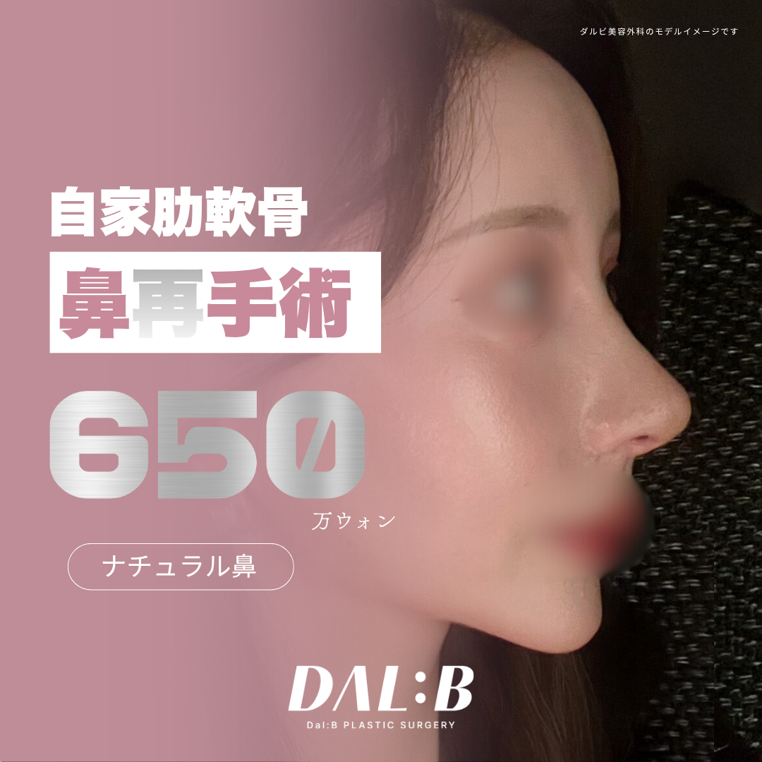 Phẫu thuật lại mũi sụn sườn tự thân | Thủ thuật an toàn với phân tích lập thể 3D-CT | Seoul ga Sinsa Dalbi Phẫu thuật Thẩm mỹ
