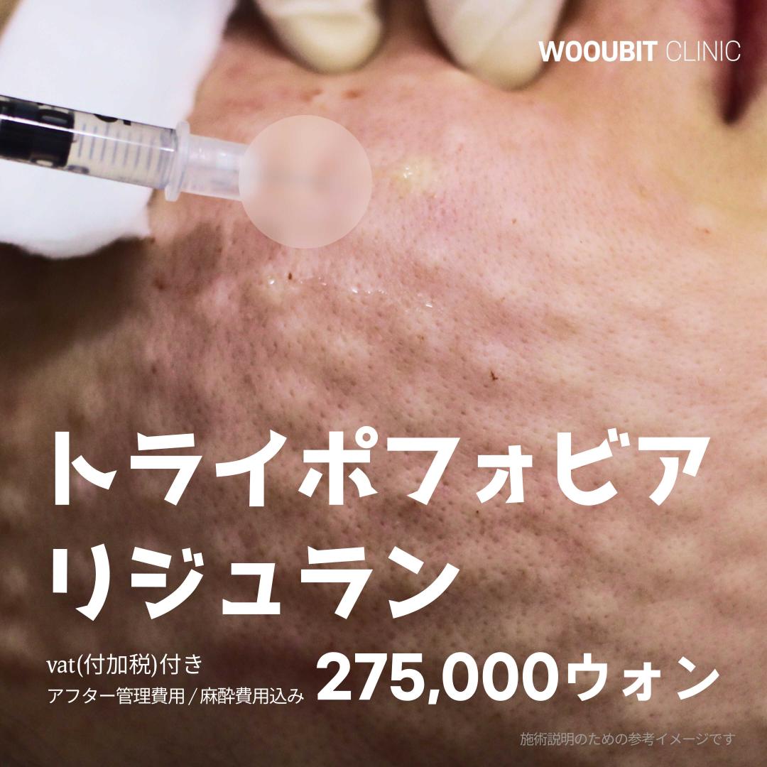 Tiêm Rejuran Healer | Chăm sóc tỉ mỉ bằng kỹ thuật tiêm tay | Có thể kỳ vọng tái tạo da, cải thiện độ căng | wooubit Clinic