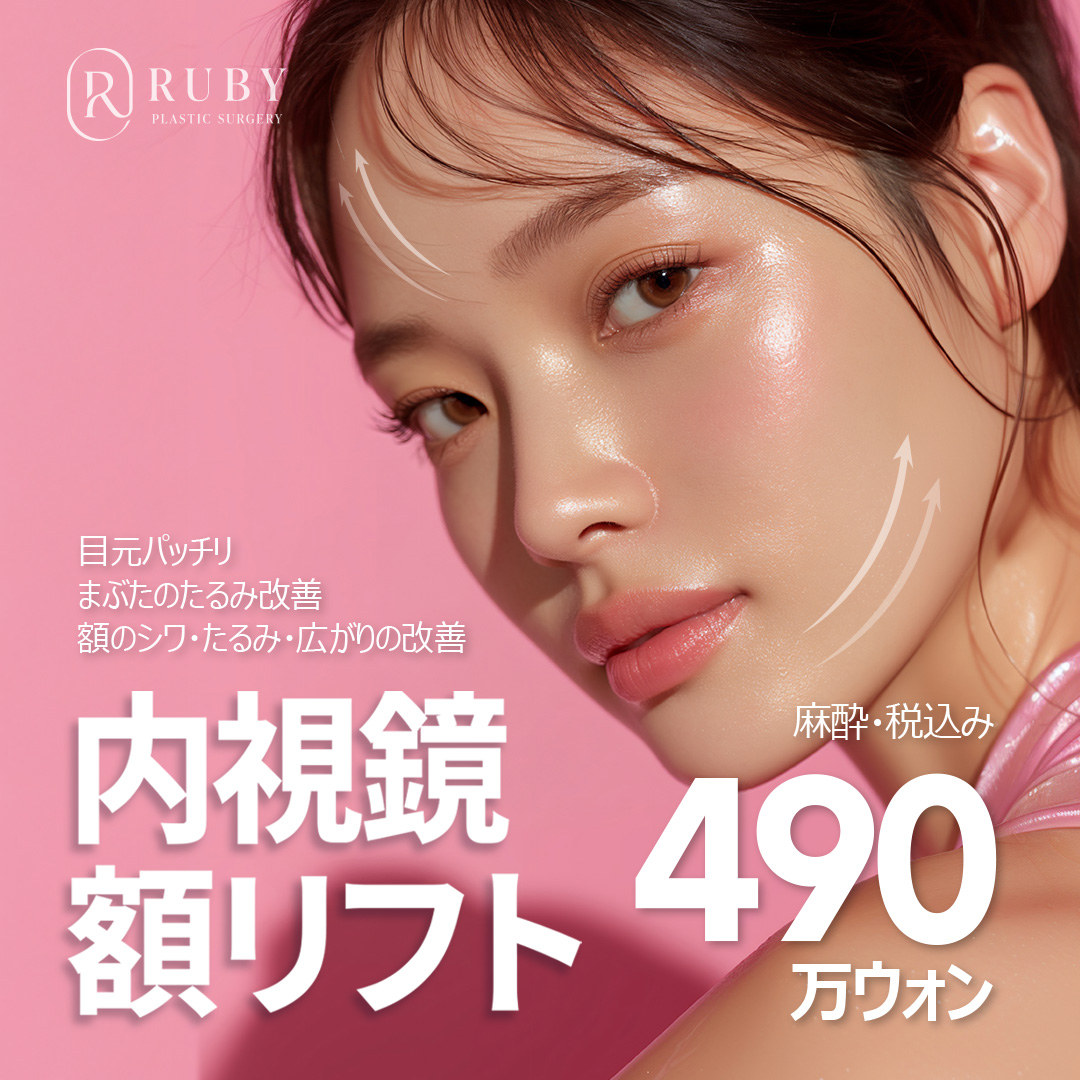 Căng da trán nội soi｜Mắt to tròn, cải thiện nếp nhăn, chảy xệ trán｜Viện thẩm mỹ Ruby, ga Sinsa, Seoul Hàn Quốc