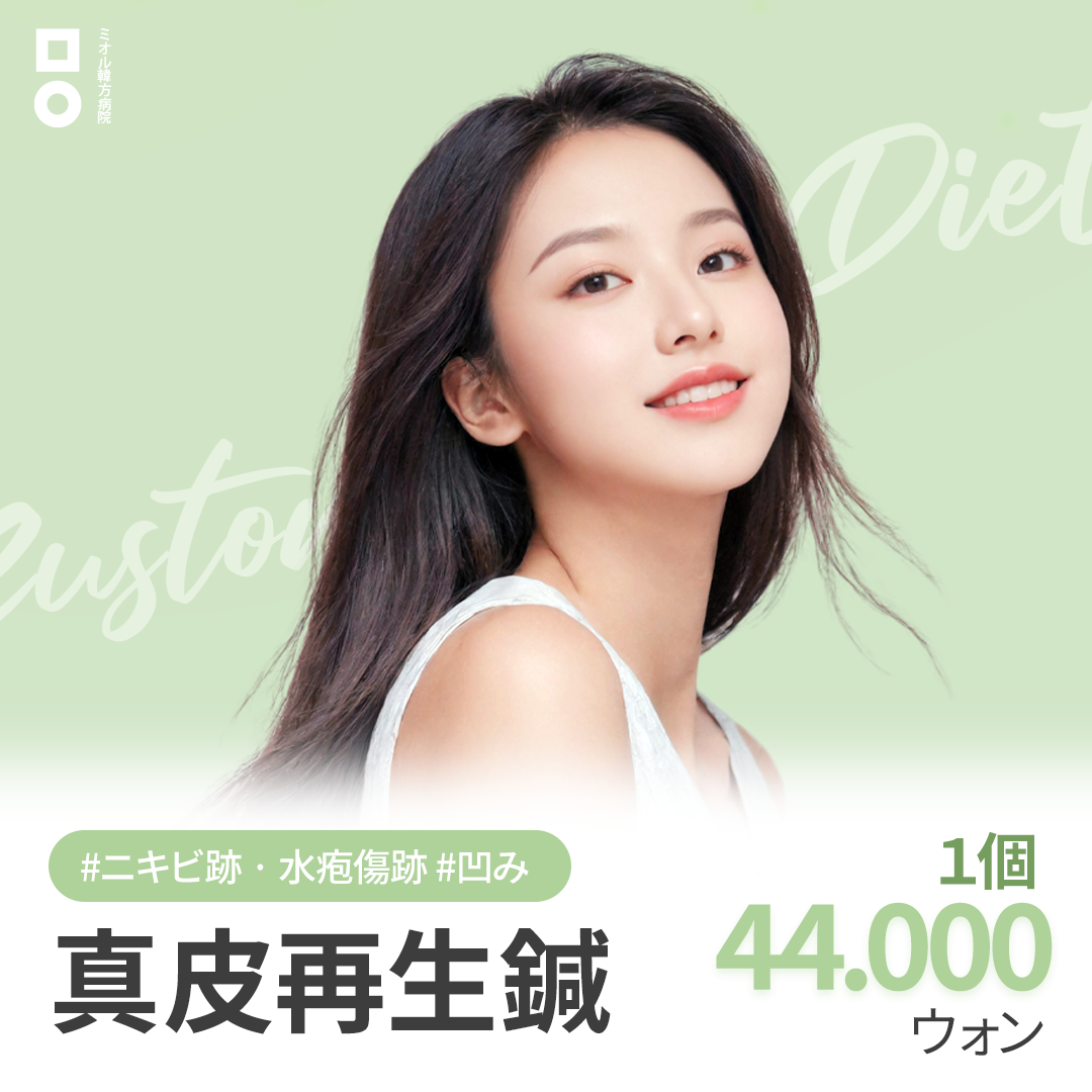 Châm cứu tái sinh hạ bì hướng đến cải thiện sẹo lõm do mụn và thủy đậu | Áp dụng kỹ thuật Flick | Miol Hàn phương Bệnh viện