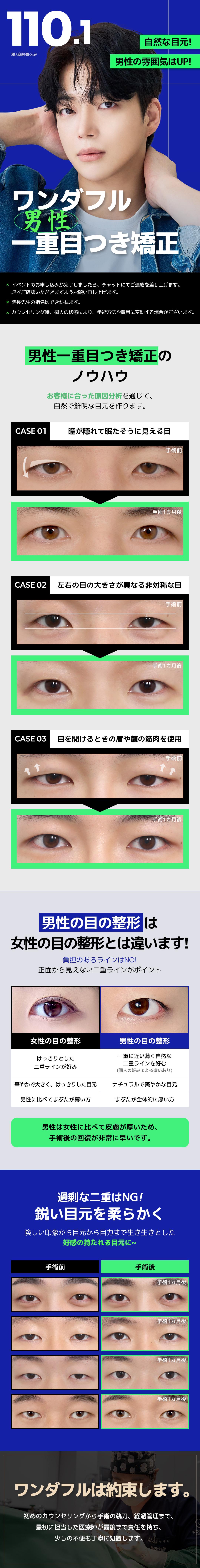 Hướng đến đường mí đôi tự nhiên với chỉnh ánh mắt mi đơn nam｜Wonderful Thẩm mỹ Gangnam【Bao gồm thuế・phí gây mê】