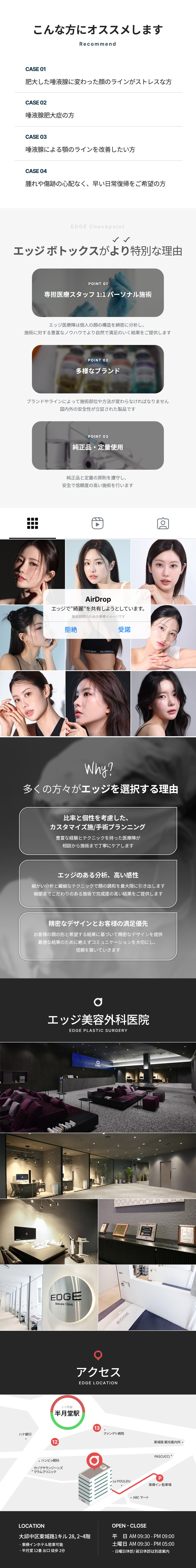 Botox tuyến nước bọt Edge Phẫu thuật Thẩm mỹ Daegu｜Thủ thuật gọn mặt hướng đến cải thiện V-line・nọng cằm