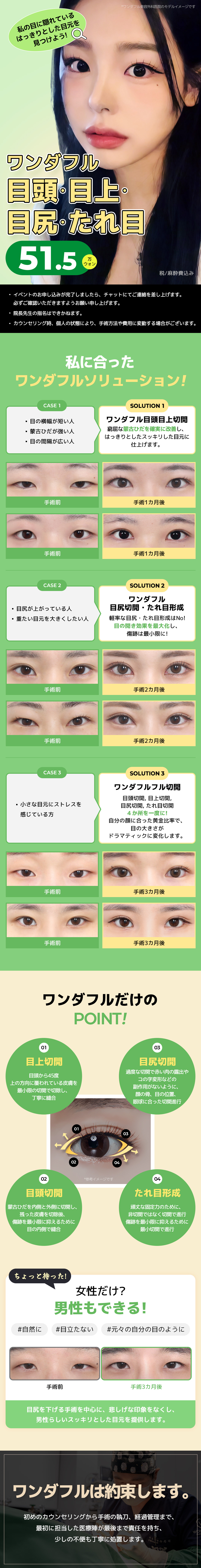 Hướng tới đôi mắt lý tưởng với cắt 4 vị trí đầu mắt・trên mắt・đuôi mắt・mắt cụp | Wonderful Thẩm mỹ Gangnam Seoul