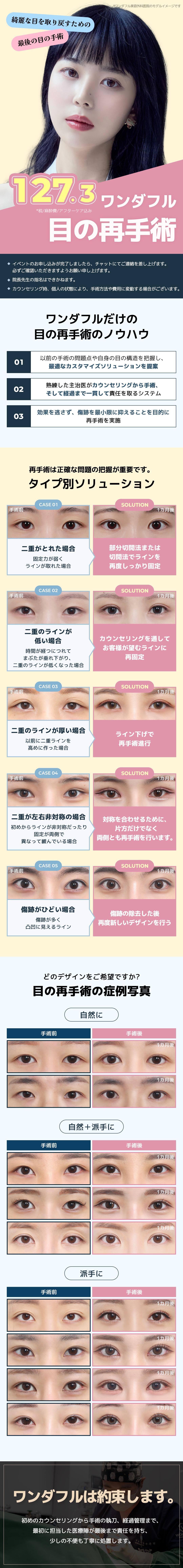Hướng tới đường nét lý tưởng với Phẫu thuật lại mắt (Chỉnh sửa mí đôi) | Bao gồm thuế・phí gây mê | Wonderful Thẩm mỹ Gangnam Seoul